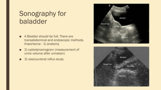 Sonography for
baladder
■ A Bladder should be full. There are
transabdominal and endoscopic methods.
Importance - 1) anatomy
■ 2) cystodynamogram (measurement of
urine volume after urination)
■ 3) vesicourteral reflux study
 