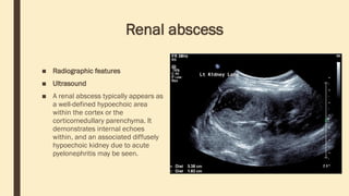 Renal abscess
■ Radiographic features
■ Ultrasound
■ A renal abscess typically appears as
a well-defined hypoechoic area
within the cortex or the
corticomedullary parenchyma. It
demonstrates internal echoes
within, and an associated diffusely
hypoechoic kidney due to acute
pyelonephritis may be seen.
 