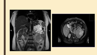Urinary system ANATOMY PHYSIOLOGY PRESERSNTATION