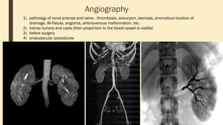 Angiography
1) pathology of renal arteries and veins - thrombosis, aneurysm, stenosis, anomalous location of
drainage, AV-fistula, angioma, arteriovenous malformation, etc.
2) kidney tumors and cysts (their proportion to the blood vessel is visible)
3) before surgery
4) endovascular procedures
 