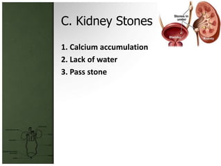 C. Kidney Stones
1. Calcium accumulation
2. Lack of water
3. Pass stone
 