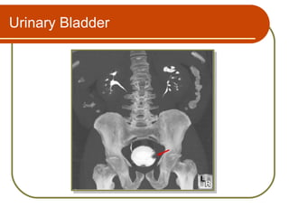 Urinary Bladder
 