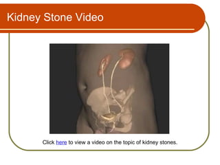 Kidney Stone Video




      Click here to view a video on the topic of kidney stones.
 
