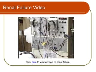 Renal Failure Video




          Click here to view a video on renal failure.
 