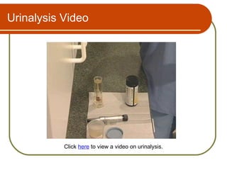 Urinalysis Video




           Click here to view a video on urinalysis.
 
