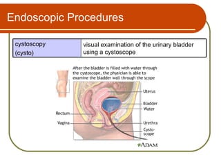 Endoscopic Procedures

 cystoscopy   visual examination of the urinary bladder
 (cysto)      using a cystoscope
 