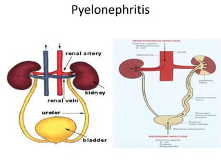 Urinary system disorders.pptx