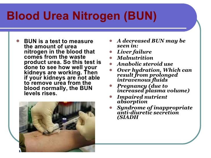 Urinary System, Id Abbrv