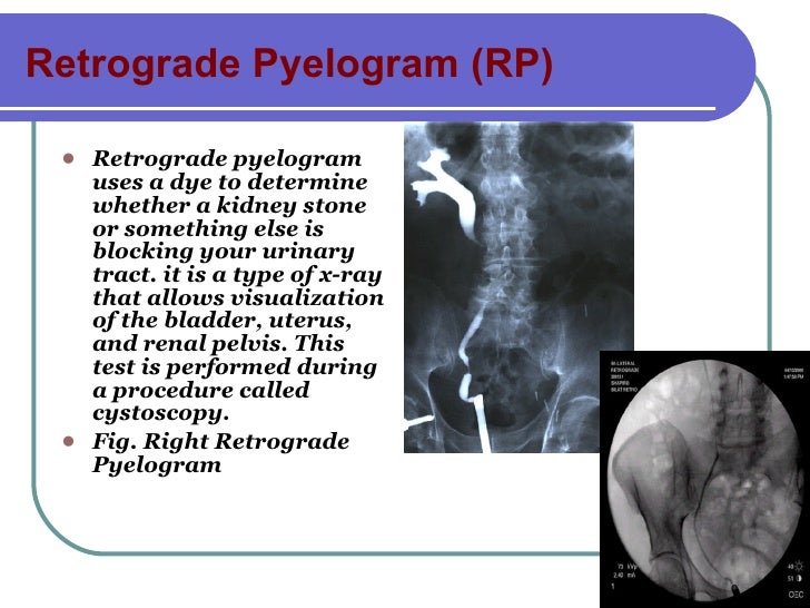 Urinary System, Id Abbrv Urinary System, Id Abbrv