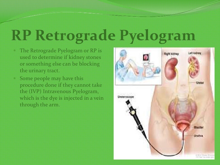 Urinary system presentation9