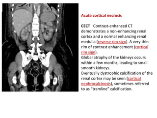 Urinary System Radiology II..pdf gyfhhuh | PDF