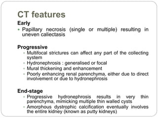 Urinary tuberculosis : Indian guidelines | PPTX