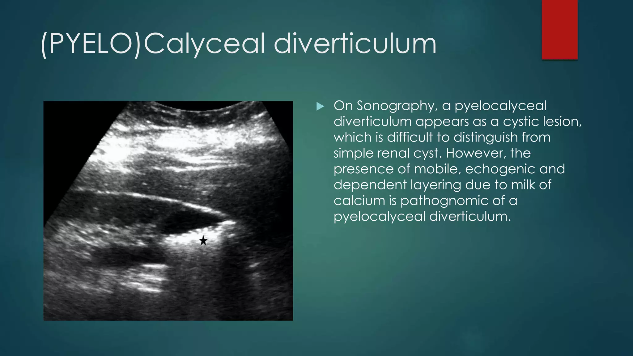 Urinary tract imaging and pathology | PPTX