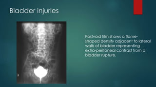 Bladder injuries
Postvoid film shows a flame-
shaped density adjacent to lateral
walls of bladder representing
extra-peritoneal contrast from a
bladder rupture.
 