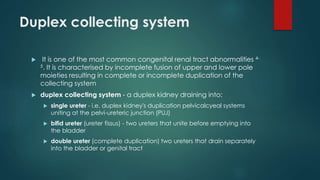 Duplex collecting system
 It is one of the most common congenital renal tract abnormalities 4-
5. It is characterised by incomplete fusion of upper and lower pole
moieties resulting in complete or incomplete duplication of the
collecting system
 duplex collecting system - a duplex kidney draining into:
 single ureter - i.e. duplex kidney's duplication pelvicalcyeal systems
uniting at the pelvi-ureteric junction (PUJ)
 bifid ureter (ureter fissus) - two ureters that unite before emptying into
the bladder
 double ureter (complete duplication) two ureters that drain separately
into the bladder or genital tract
 