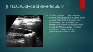 (PYELO)Calyceal diverticulum
 On Sonography, a pyelocalyceal
diverticulum appears as a cystic lesion,
which is difficult to distinguish from
simple renal cyst. However, the
presence of mobile, echogenic and
dependent layering due to milk of
calcium is pathognomic of a
pyelocalyceal diverticulum.
 