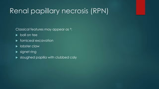 Renal papillary necrosis (RPN)
Classical features may appear as 4:
 ball on tee
 forniceal excavation
 lobster claw
 signet ring
 sloughed papilla with clubbed caly
 