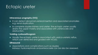 Ectopic ureter
Intravenous urography (IVU)
 It can detect abnormal ureteral insertion and associated anomalies
e.g. renal duplication.
 In complete duplex kidney and ureter, the ectopic ureter usually
drains the upper moiety and associated with ureterocele and
obstruction.
Voiding cystourethrogram
 Usually the ectopic ureter is associated with vesico-ureteric reflux,
which can detected and graded with VCUG.
Ultrasound
 Associations and complications such as duplex
kidneys, hydronephrosis andureterocoele can be also be assessed.
 