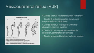 Vesicoureteral reflux (VUR)
• Grade I: reflux to ureter but not to kidney
• Grade II: reflux into ureter, pelvis, and
calyces without dilatations
• Grade III: reflux to calyces with mild
dilatation,blunted fornices
• Grade IV: to calyces with moderate
dilatation,obliteration of fornices
• Grade V: gross dilatation, tortuous ureters.
 