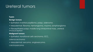 Ureteral tumors
Types
Benign tumors
• Epithelial: inverted papilloma, polyp, adenoma
• Mesodermal: fibroma, hemangioma, myoma, lymphangioma
• Fibroepithelial polyp: mobile long intraluminal mass, ureteral
intussusception
Malignant tumors
• Epithelial: transitional cell carcinoma, SCC,
adenocarcinoma
• Mesodermal: sarcoma, angiosarcoma,
carcinosarcoma
 