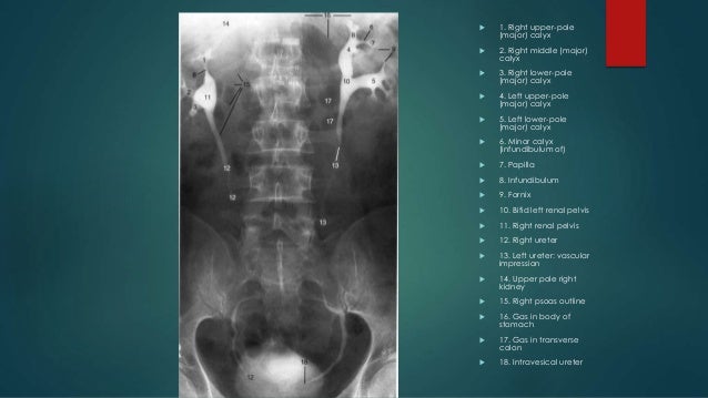 Urinary tract imaging and pathology