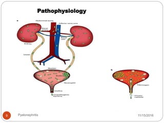 Pathophysiology
11/15/2016Pyelonephritis9
 