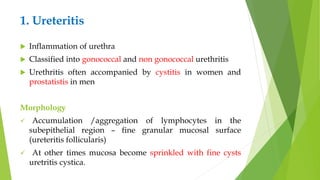 1. Ureteritis
 Inflammation of urethra
 Classified into gonococcal and non gonococcal urethritis
 Urethritis often accompanied by cystitis in women and
prostatistis in men
Morphology
 Accumulation /aggregation of lymphocytes in the
subepithelial region – fine granular mucosal surface
(ureteritis follicularis)
 At other times mucosa become sprinkled with fine cysts
uretritis cystica.
 