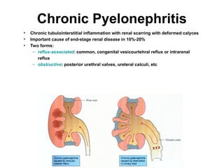 Chronic Pyelonephritis
• Chronic tubulointerstitial inflammation with renal scarring with deformed calyces
• Important cause of end-stage renal disease in 10%-20%
• Two forms:
– reflux-associated: common, congenital vesicourtehral reflux or intrarenal
reflux
– obstructive: posterior urethral valves, ureteral calculi, etc
 