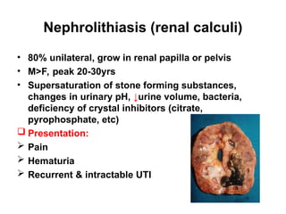 Nephrolithiasis (renal calculi)
• 80% unilateral, grow in renal papilla or pelvis
• M>F, peak 20-30yrs
• Supersaturation of stone forming substances,
changes in urinary pH, ↓urine volume, bacteria,
deficiency of crystal inhibitors (citrate,
pyrophosphate, etc)
 Presentation:
 Pain
 Hematuria
 Recurrent & intractable UTI
 