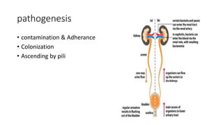 pathogenesis
• contamination & Adherance
• Colonization
• Ascending by pili
 