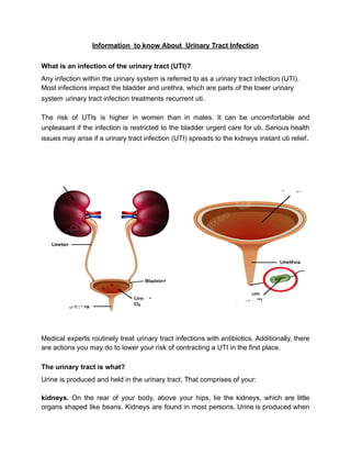 Information to know About Urinary Tract Infection
What is an infection of the urinary tract (UTI)?
Any infection within the urinary system is referred to as a urinary tract infection (UTI).
Most infections impact the bladder and urethra, which are parts of the lower urinary
system urinary tract infection treatments recurrent uti.
The risk of UTIs is higher in women than in males. It can be uncomfortable and
unpleasant if the infection is restricted to the bladder urgent care for uti. Serious health
issues may arise if a urinary tract infection (UTI) spreads to the kidneys instant uti relief.
Medical experts routinely treat urinary tract infections with antibiotics. Additionally, there
are actions you may do to lower your risk of contracting a UTI in the first place.
The urinary tract is what?
Urine is produced and held in the urinary tract. That comprises of your:
kidneys. On the rear of your body, above your hips, lie the kidneys, which are little
organs shaped like beans. Kidneys are found in most persons. Urine is produced when
 