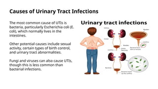 Urinary Tract Infection copy.pptx………………… | PPTX