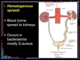 • Hematogenous
spread:
 Blood borne
spread to kidneys.
 Occurs in
bacteraemia
mostly S.aureus.
 