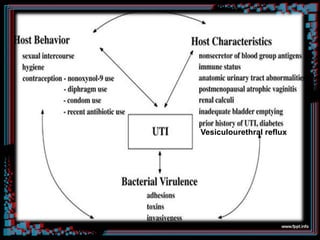 Vesiculourethral reflux
 