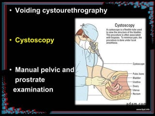 • Voiding cystourethrography
• Cystoscopy
• Manual pelvic and
prostrate
examination
 