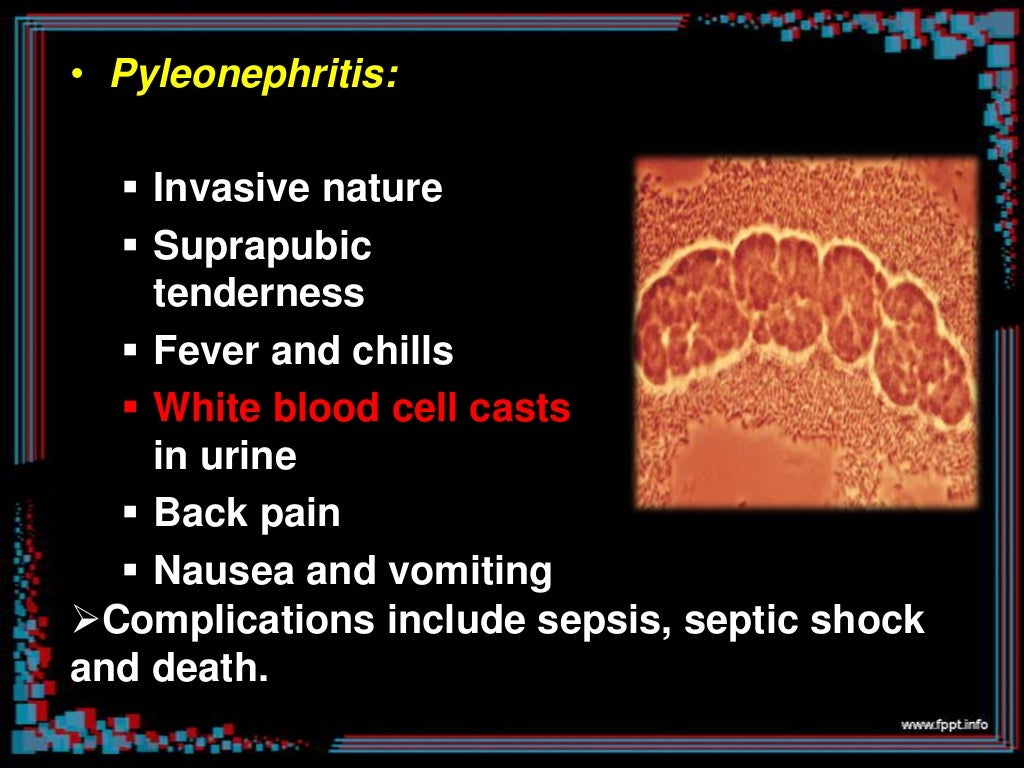 Urinary tract infections