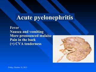 Acute pyelonephritis
Fever
Nausea and vomiting
More pronounced malaise
Pain in the back
(+) CVA tenderness

Friday, October 18, 2013

 