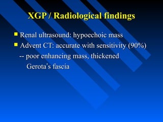 XGP / Radiological findings
Renal ultrasound: hypoechoic mass
 Advent CT: accurate with sensitivity (90%)
-- poor enhancing mass, thickened
Gerota’s fascia


 