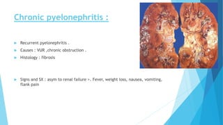 Chronic pyelonephritis :
 Recurrent pyelonephritis .
 Causes : VUR ,chronic obstruction .
 Histology : fibrosis
 Signs and SX : asym to renal failure >. Fever, weight loss, nausea, vomiting,
flank pain
 