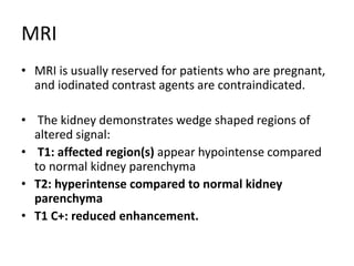 MRI
• MRI is usually reserved for patients who are pregnant,
and iodinated contrast agents are contraindicated.
• The kidney demonstrates wedge shaped regions of
altered signal:
• T1: affected region(s) appear hypointense compared
to normal kidney parenchyma
• T2: hyperintense compared to normal kidney
parenchyma
• T1 C+: reduced enhancement.
 