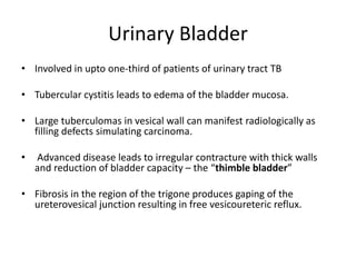 Urinary Bladder
• Involved in upto one-third of patients of urinary tract TB
• Tubercular cystitis leads to edema of the bladder mucosa.
• Large tuberculomas in vesical wall can manifest radiologically as
filling defects simulating carcinoma.
• Advanced disease leads to irregular contracture with thick walls
and reduction of bladder capacity – the “thimble bladder”
• Fibrosis in the region of the trigone produces gaping of the
ureterovesical junction resulting in free vesicoureteric reflux.
 