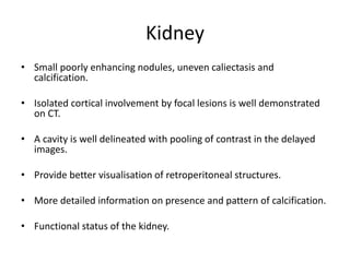 Kidney
• Small poorly enhancing nodules, uneven caliectasis and
calcification.
• Isolated cortical involvement by focal lesions is well demonstrated
on CT.
• A cavity is well delineated with pooling of contrast in the delayed
images.
• Provide better visualisation of retroperitoneal structures.
• More detailed information on presence and pattern of calcification.
• Functional status of the kidney.
 