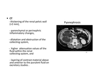  CT
- thickening of the renal pelvic wall
(>2 mm),
- parenchymal or perinephric
inflammatory changes,
- dilatation and obstruction of the
collecting system,
- higher attenuation values of the
fluid within the renal
collecting system, and
- layering of contrast material above
and anterior to the purulent fluid on
excretory studies .
 