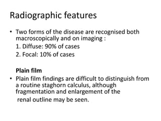 Radiographic features
• Two forms of the disease are recognised both
macroscopically and on imaging :
1. Diffuse: 90% of cases
2. Focal: 10% of cases
Plain film
• Plain film findings are difficult to distinguish from
a routine staghorn calculus, although
fragmentation and enlargement of the
renal outline may be seen.
 