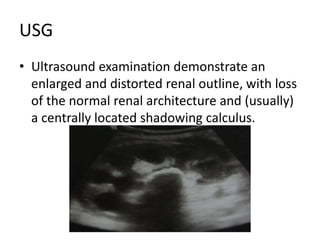 USG
• Ultrasound examination demonstrate an
enlarged and distorted renal outline, with loss
of the normal renal architecture and (usually)
a centrally located shadowing calculus.
 