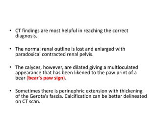 • CT findings are most helpful in reaching the correct
diagnosis.
• The normal renal outline is lost and enlarged with
paradoxical contracted renal pelvis.
• The calyces, however, are dilated giving a multloculated
appearance that has been likened to the paw print of a
bear (bear's paw sign).
• Sometimes there is perinephric extension with thickening
of the Gerota's fascia. Calcification can be better delineated
on CT scan.
 
