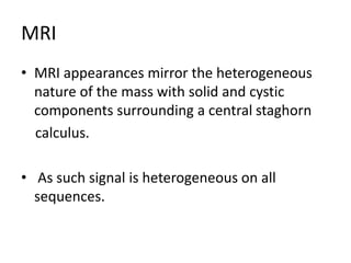 MRI
• MRI appearances mirror the heterogeneous
nature of the mass with solid and cystic
components surrounding a central staghorn
calculus.
• As such signal is heterogeneous on all
sequences.
 