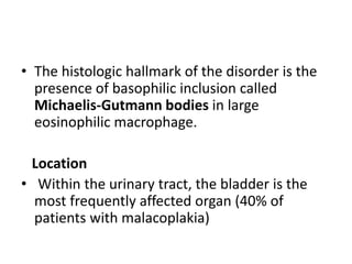 • The histologic hallmark of the disorder is the
presence of basophilic inclusion called
Michaelis-Gutmann bodies in large
eosinophilic macrophage.
Location
• Within the urinary tract, the bladder is the
most frequently affected organ (40% of
patients with malacoplakia)
 