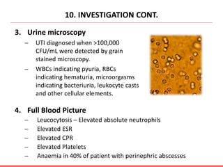 10. INVESTIGATION CONT.
3. Urine microscopy
 UTI diagnosed when >100,000
CFU/mL were detected by grain
stained microscopy.
 WBCs indicating pyuria, RBCs
indicating hematuria, microorgasms
indicating bacteriuria, leukocyte casts
and other cellular elements.
4. Full Blood Picture
 Leucocytosis – Elevated absolute neutrophils
 Elevated ESR
 Elevated CPR
 Elevated Platelets
 Anaemia in 40% of patient with perinephric abscesses
 