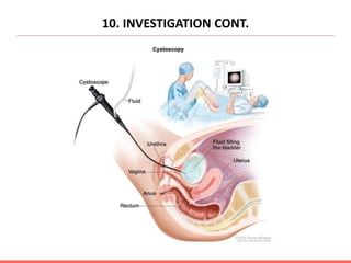 10. INVESTIGATION CONT.
 